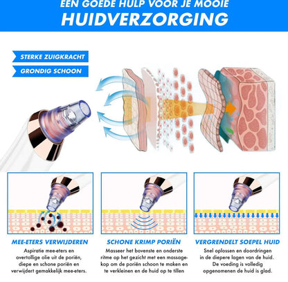Elektryczny Usuwacz Zaskórników
